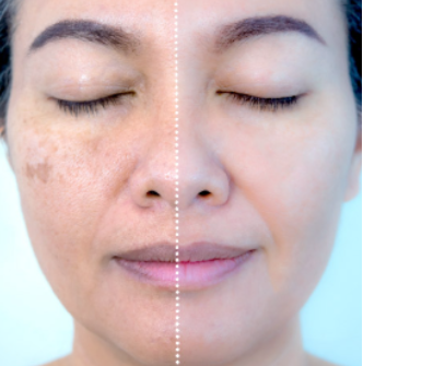 Resultado antes e depois 2